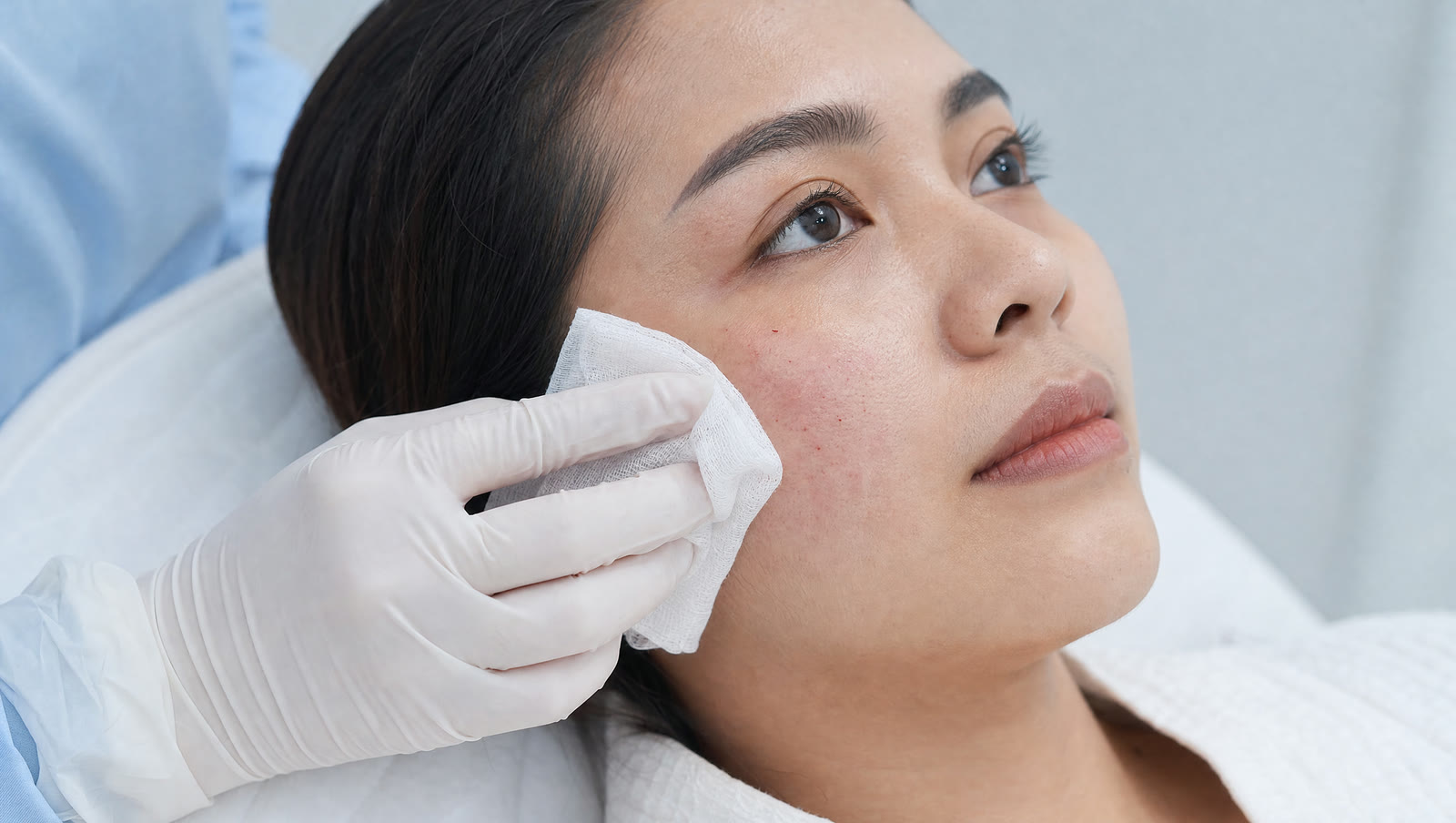 Dokter menempelkan kompres dingin pada pipi pasien yang sedikit kemerahan setelah treatment skin booster Juvelook