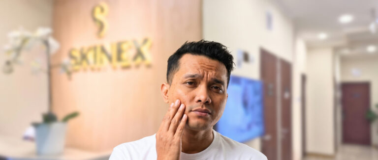 Pria memegang pipi dengan kulit wajah kusam di Skinex Clinic Bintaro
